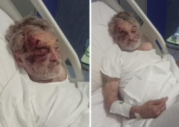 Cosenza, assurda aggressione al clochard Cristofer,  conosciuto, da molti cosentini, come “Cristian”