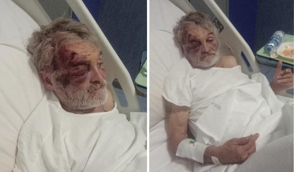 Cosenza, assurda aggressione al clochard Cristofer,  conosciuto, da molti cosentini, come “Cristian”